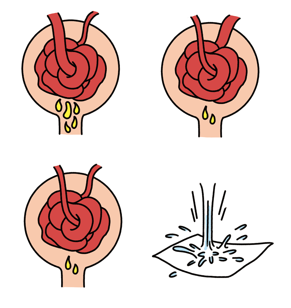 腎臓での尿生成プロセスを示す4段階のイラスト