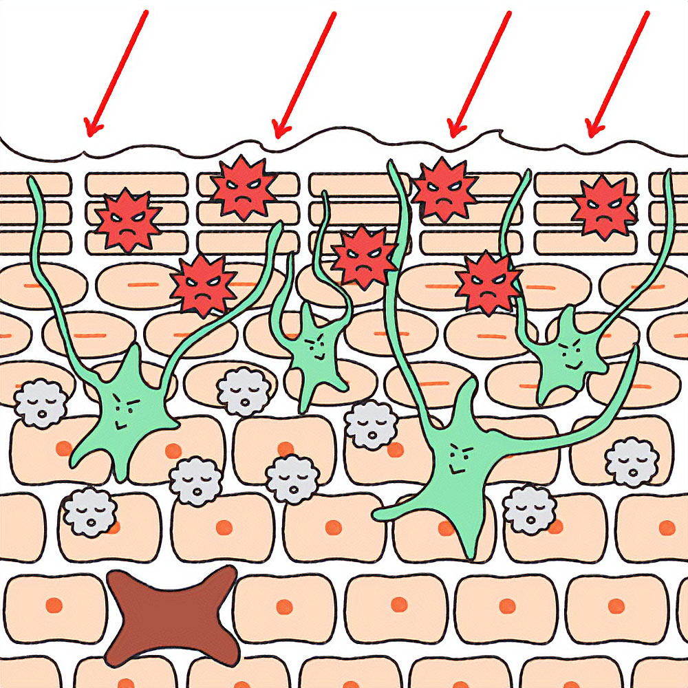 皮膚細胞の炎症を描いたイラスト